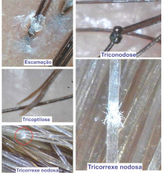Capilar-ocorrências