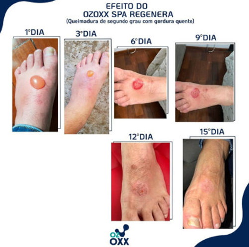 Oleo ozonizado SPA Regenera + Ozoxx Ar