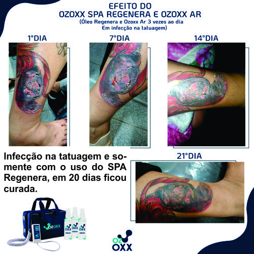 Oleo ozonizado SPA Regenera + Ozoxx Ar